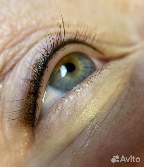 Татуаж, Карбоновый пилинг, Лазер, Косметология