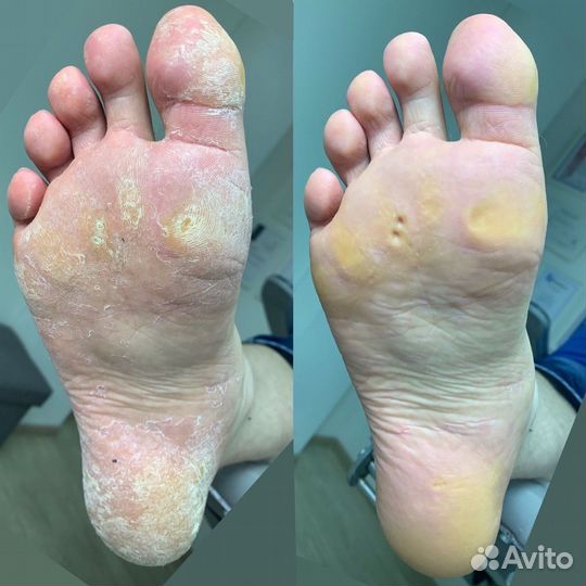 Модель на педикюр