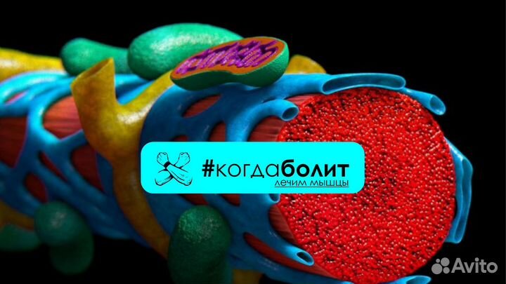 Миотерапия, лечение хронической боли, выезд на дом