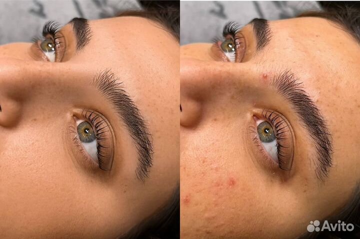 Обработка фотографий, ретушь для бьюти мастеров