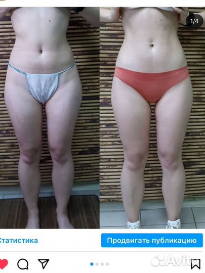 Антицеллюлитный массаж и обертывание