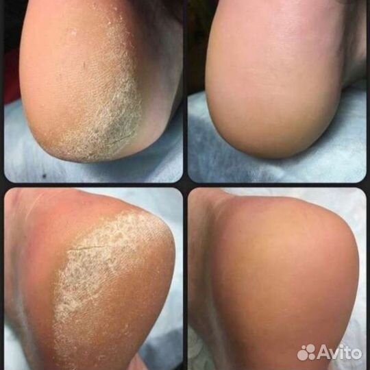 Обрезной /станком/педикюр, мужской, женский