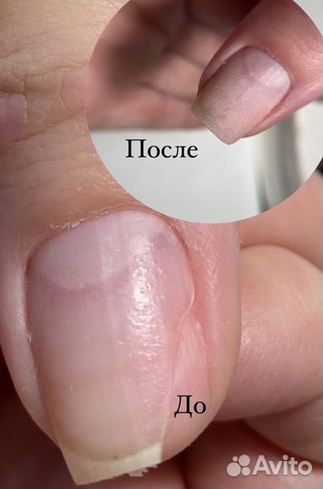 Маникюр, педикюр