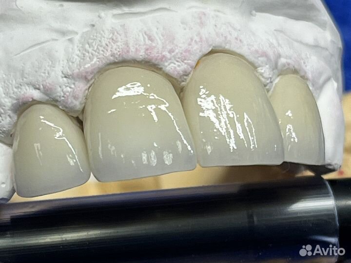 Зубной Техник