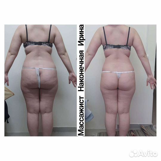 Массаж лечебный/Коррекция фигуры