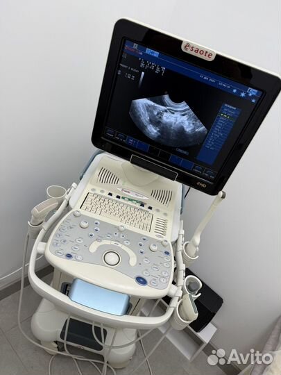 Узи аппарат бу Mylab 40