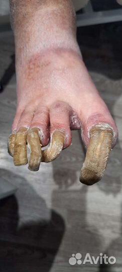 Услуги подолога