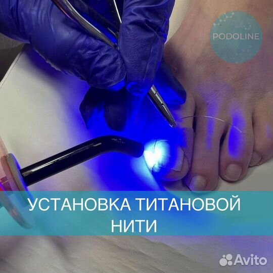 Подолог, вросший ноготь, грибок, отслоение