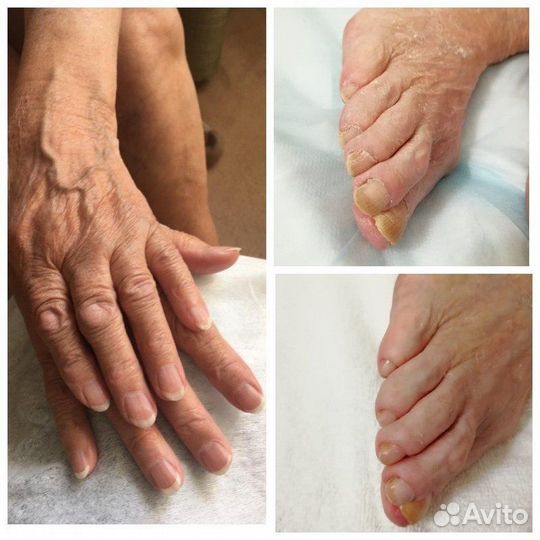 Подолог. Лечебный педикюр. Без боли