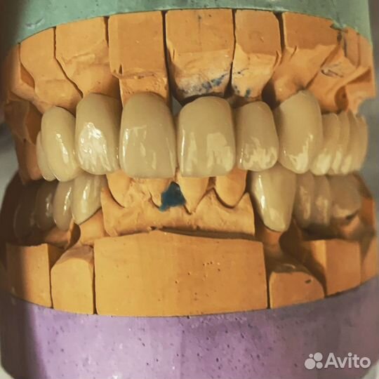 Приглашаю стоматологов ортопедов к сотрудничеству