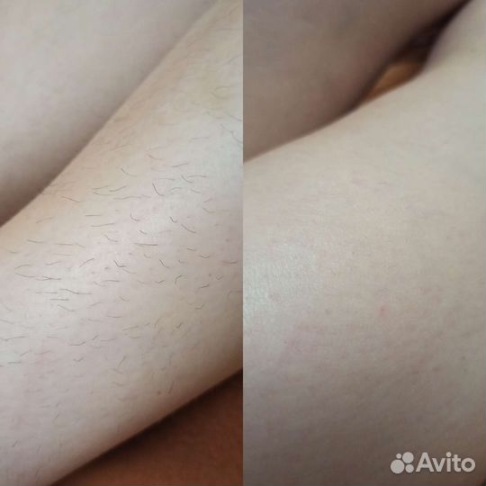 Мастер шугаринга