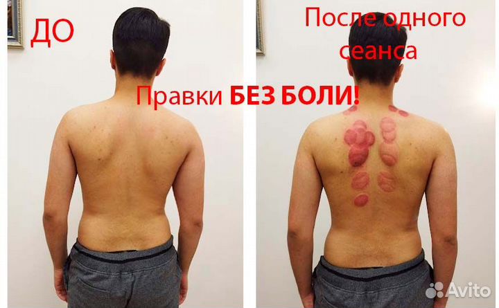 Мануальный Массаж. Костоправ. Без Боли