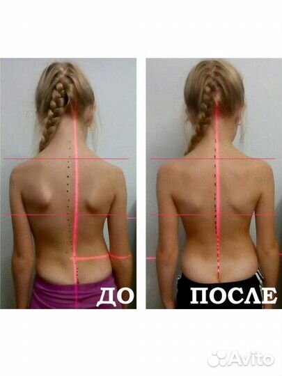 Массаж общий для Всех и каждого