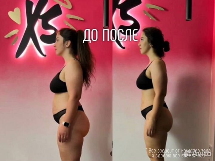 Антицеллюлитный массаж / Классический массаж