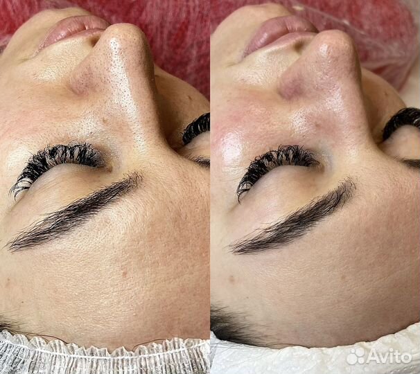 Косметолог /Чистка /Массаж/Мезотерапия Светлогорск