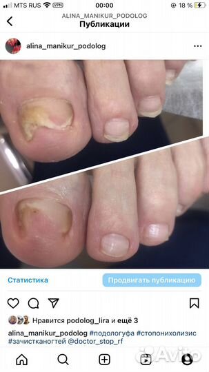 Маникюр/педикюр/подолог