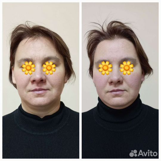 Скульптурный массаж лица