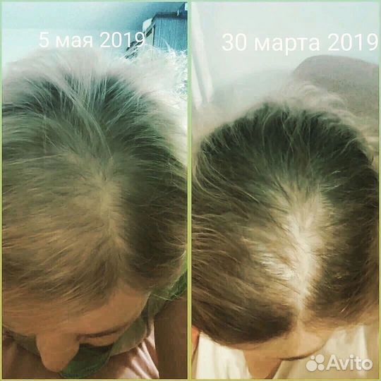 Натуральные маски для волос