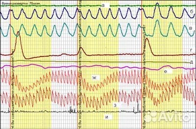 Проверки на полиграфе