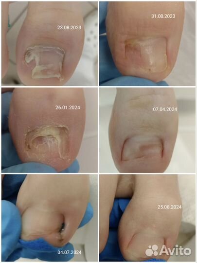 Подолог с выездом на дом