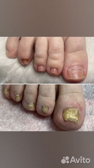 Услуги подолога