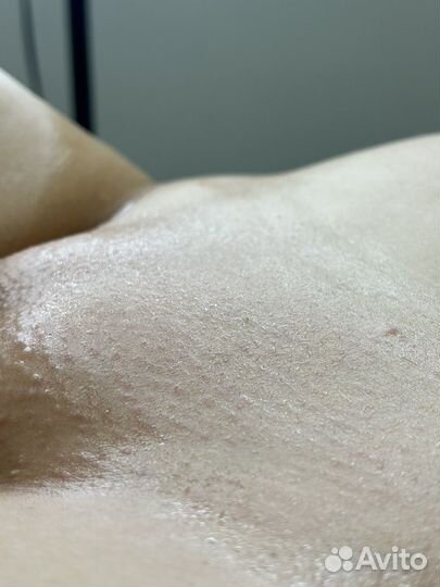 Шугаринг депиляция