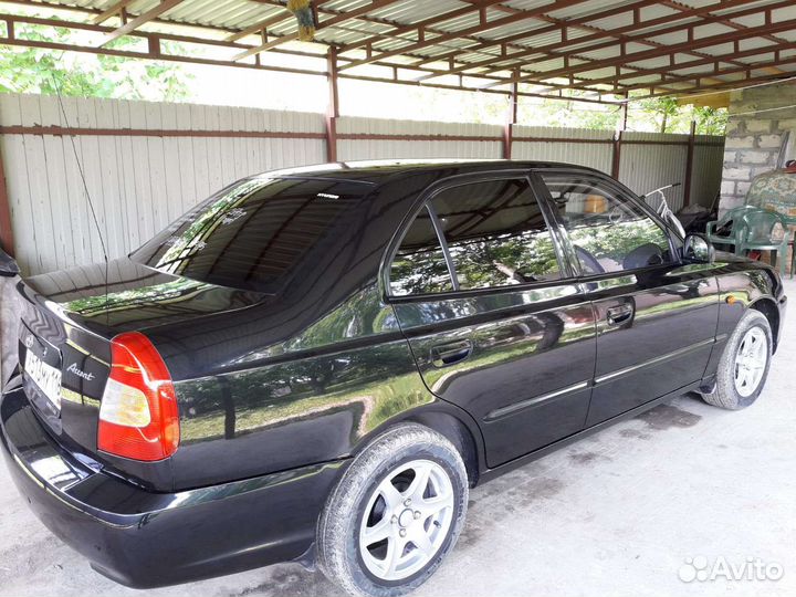 Полировка фар. Авто. Химчистка.удаление царапин