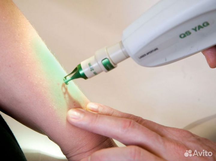 Франшиза лазерной эпиляции в топовой локации