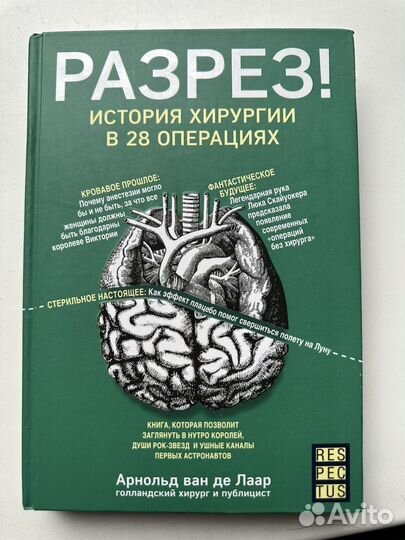 Арнольд ван де Лаар - Разрез