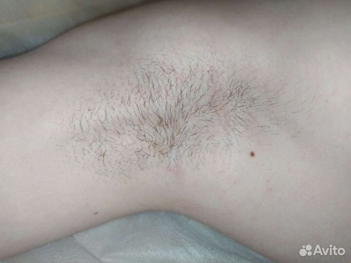 Депиляция сахарной пастой и воском