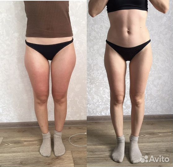 Массаж лица, антицеллюлитный, классический, лимфо