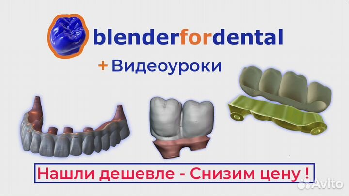 Blender for dental (B4D) iBar (балки) и все модули