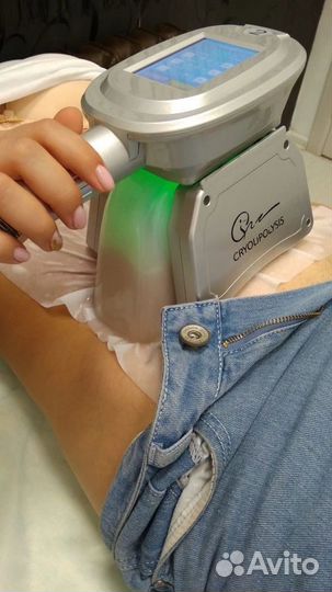 Криолиполиз -минус размер за одну процедуру