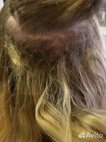 Ленточное наращивание волос