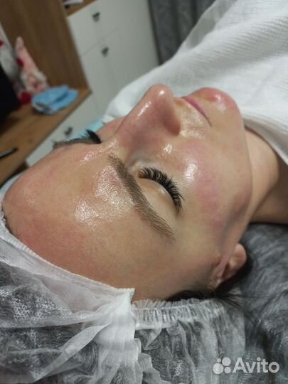 Чистка лица/RFлифтинг/Массаж лица/Пилинг