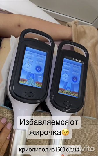 Криолиполиз