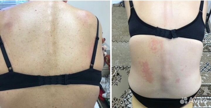 Костоправ, мануальный массаж, мед. образование