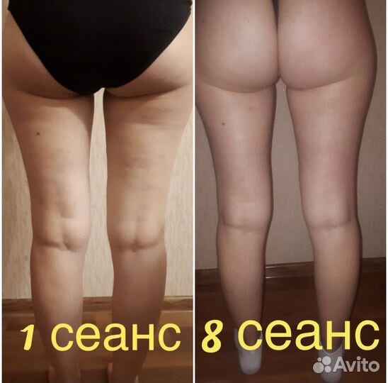 Массаж ручной и аппаратный