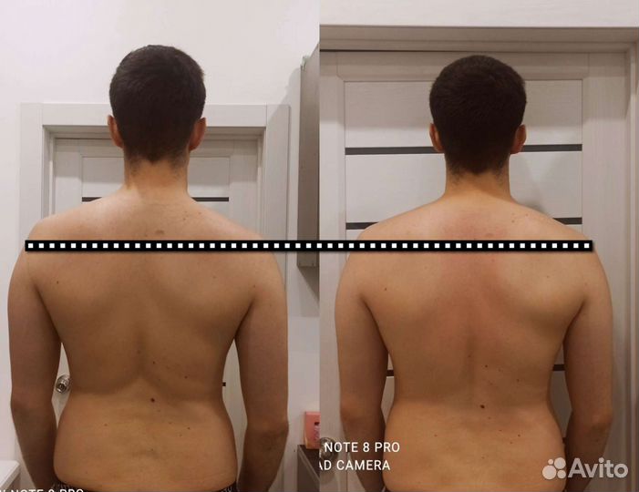 Массаж Челябинск (реабилитолог)