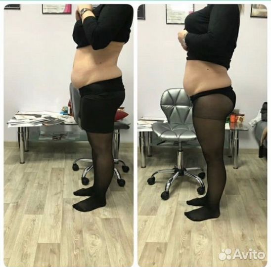 LPG массаж, Жиротоп microwave korea, Массаж лица