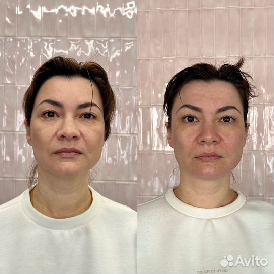 Массаж лица