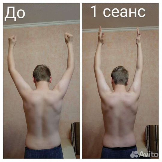 Миофасциальный массаж