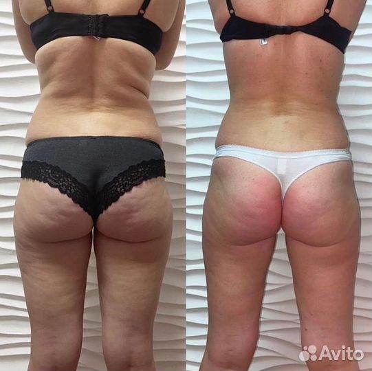 Массаж на дому. Ладожская