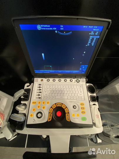 Портативный узи аппарат GE Logiq e
