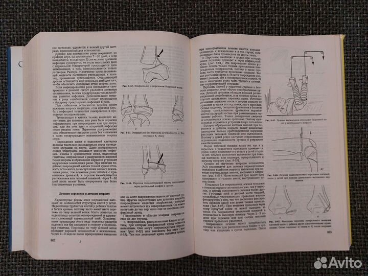Оперативная Хирургия. Имре Литтманн