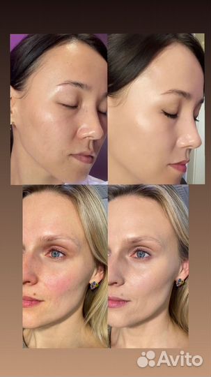 Кушон атоми