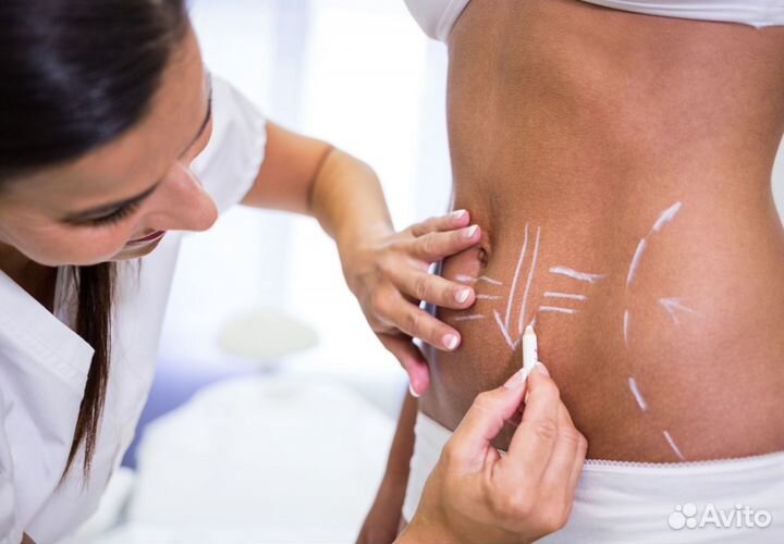 Криолиполиз - убирает жировые складки без операций