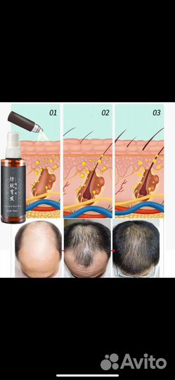 Тоник против выпадения волос