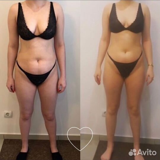 Вакуумно роликовый массаж,похудение