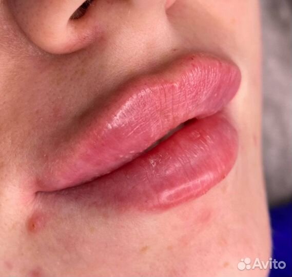 Услуги косметолога